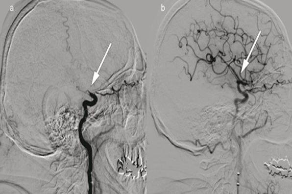Heart and Vascular Surgery
