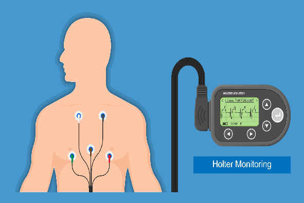 Holter