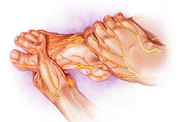 Neuropathy