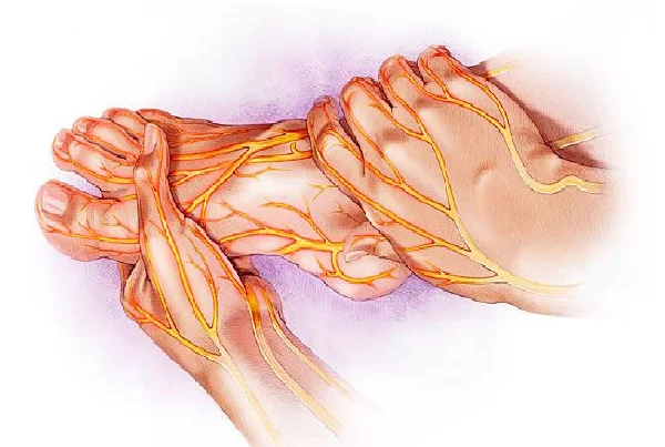 Neuropathy